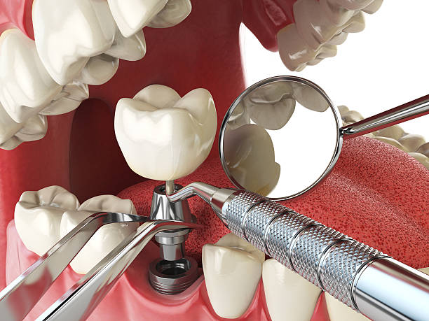 Best Urgent Tooth Repair  in Wendell, NC